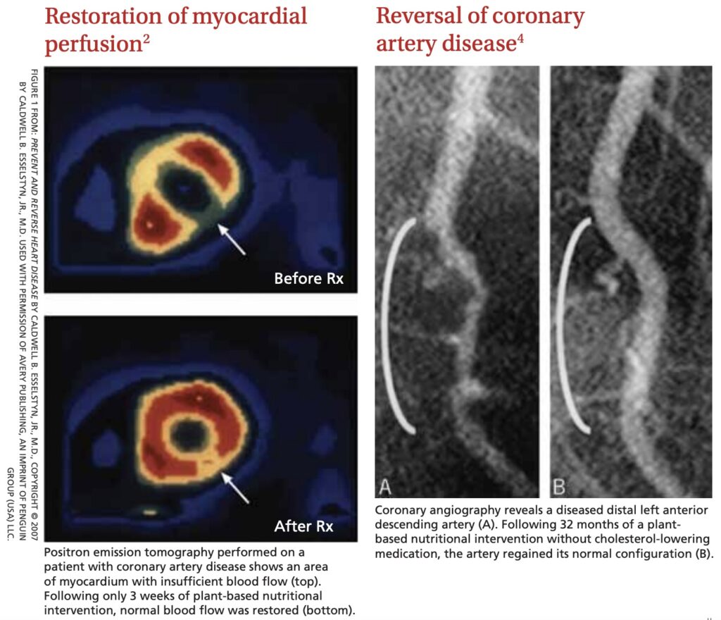 Efeito terapêutico de um padrão alimentar baseado em plantas